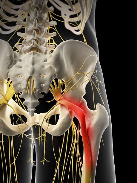 poze cu nervul sciatic|Fotografii de stoc cu Nervul Sciatic